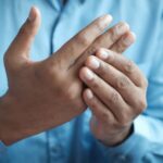 Chronic Pain - person in blue shirt showing left hand